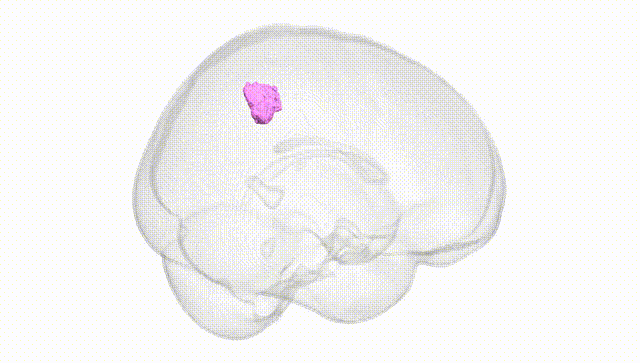 Full Brain White