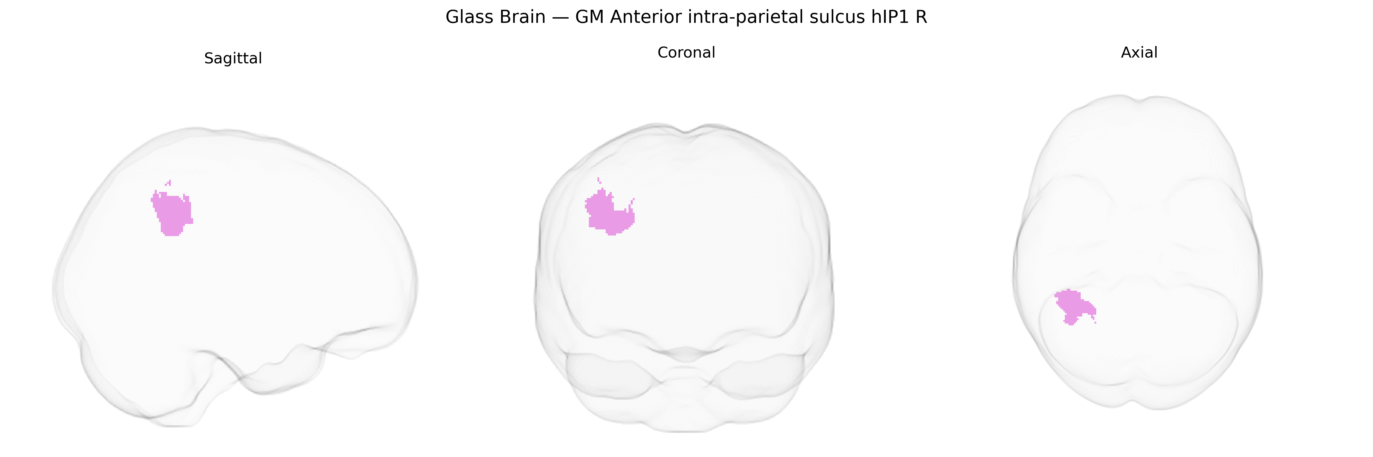 Triplanar Ghost Brain