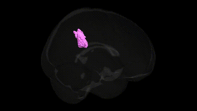 Full Brain Black