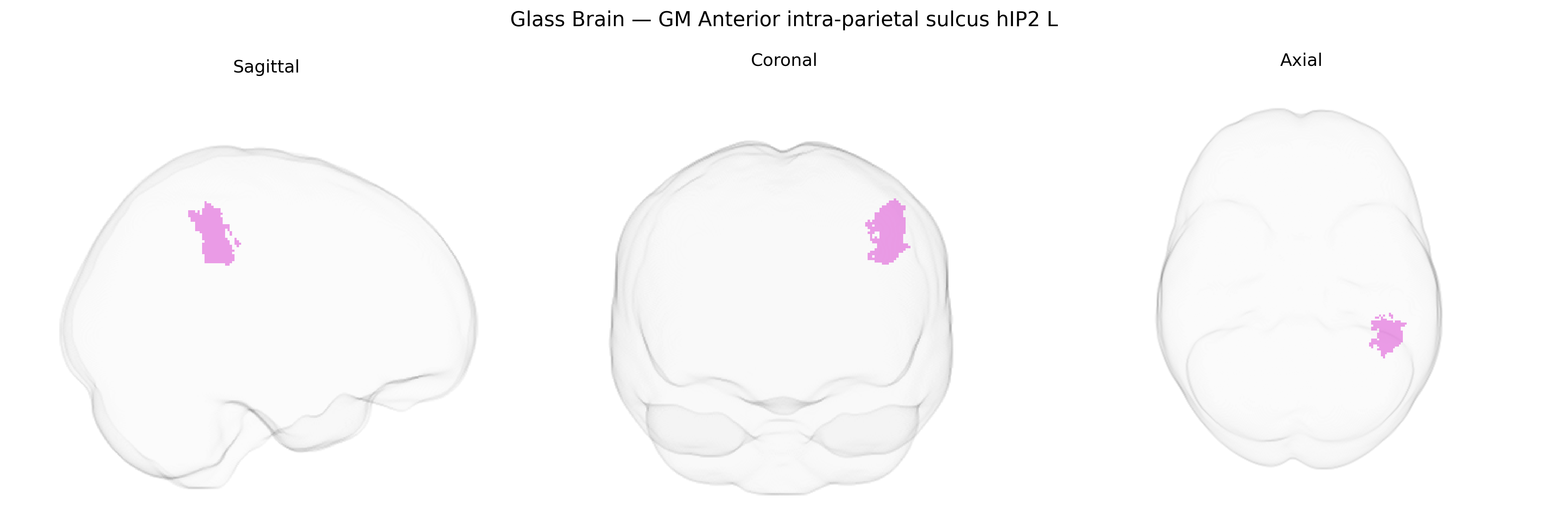 Triplanar Ghost Brain