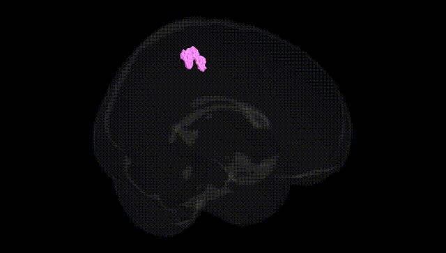 Full Brain Black