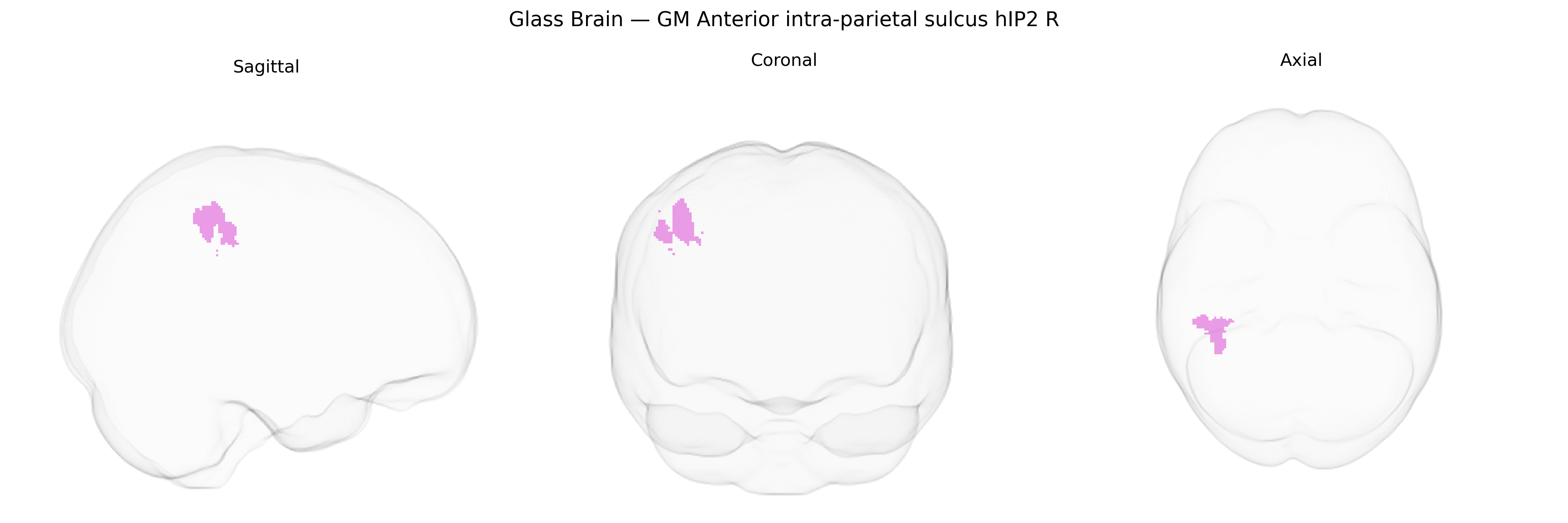 Triplanar Ghost Brain