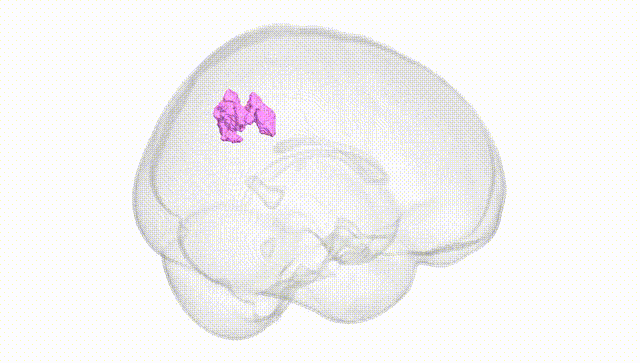 Full Brain White