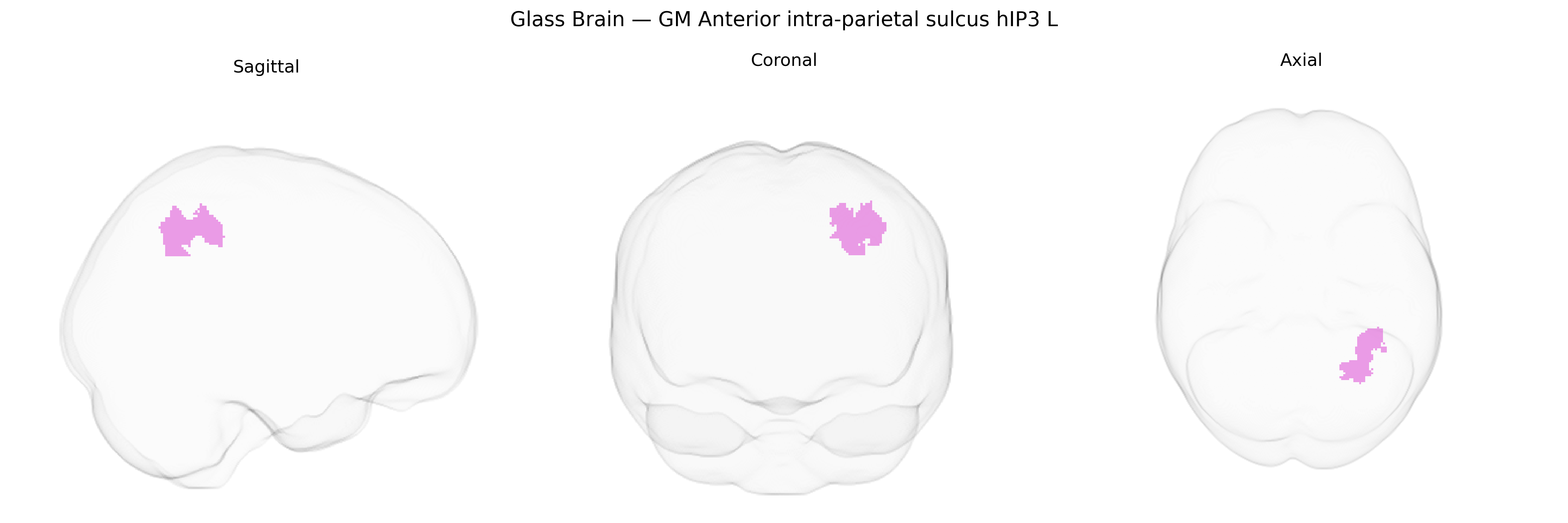 Triplanar Ghost Brain