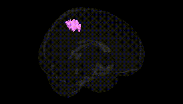 Full Brain Black