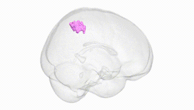 Full Brain White