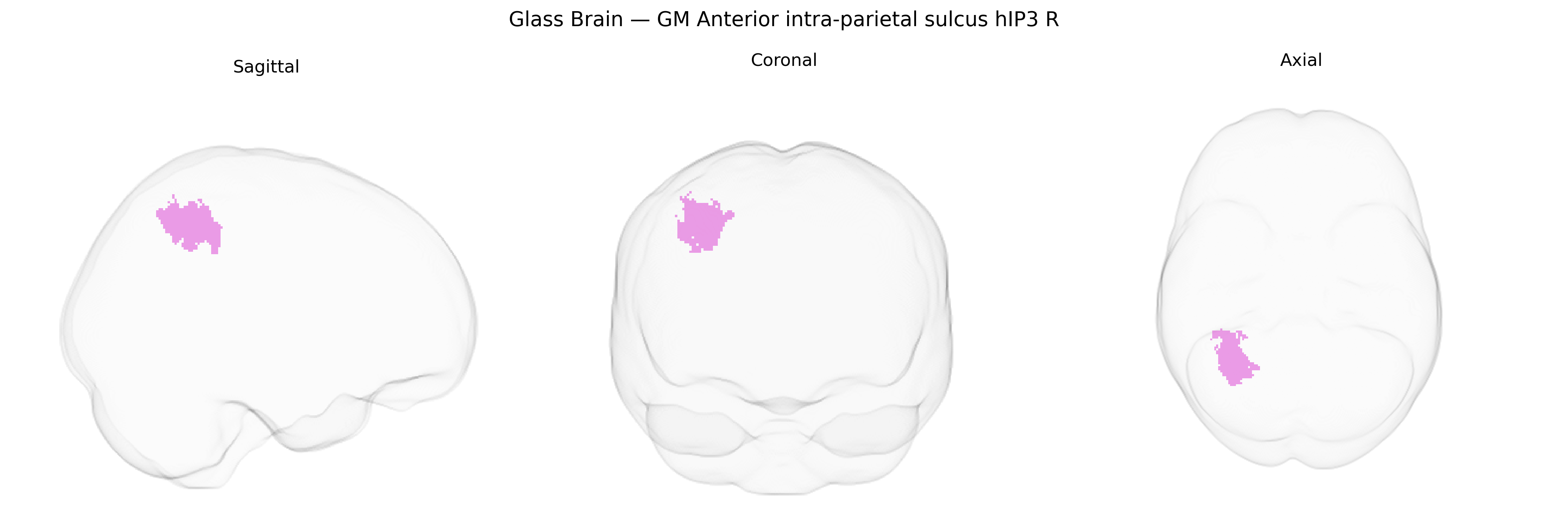 Triplanar Ghost Brain