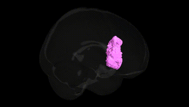 Full Brain Black