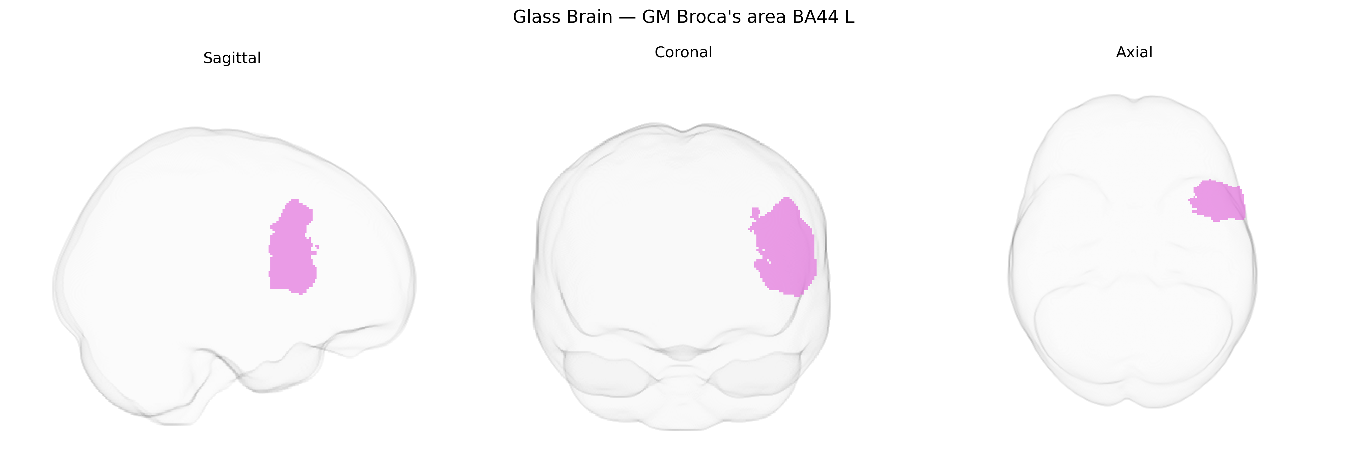 Triplanar Ghost Brain