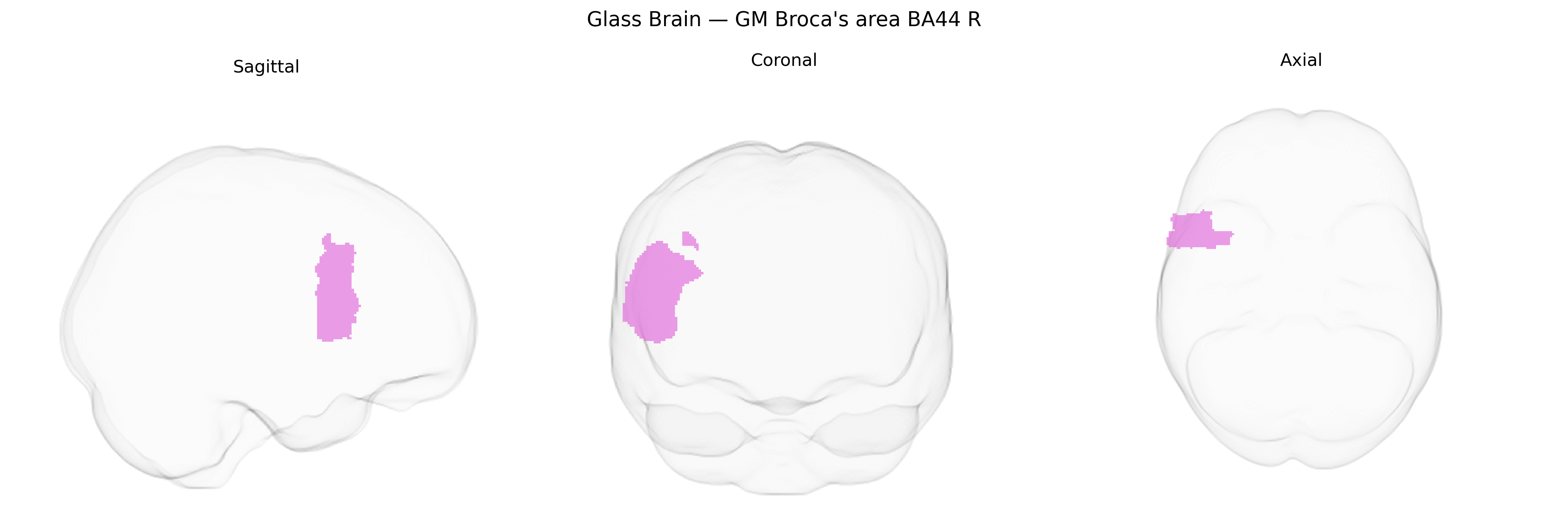 Triplanar Ghost Brain