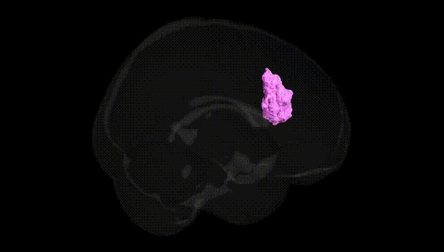 Full Brain Black