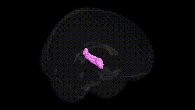 Full Brain Black
