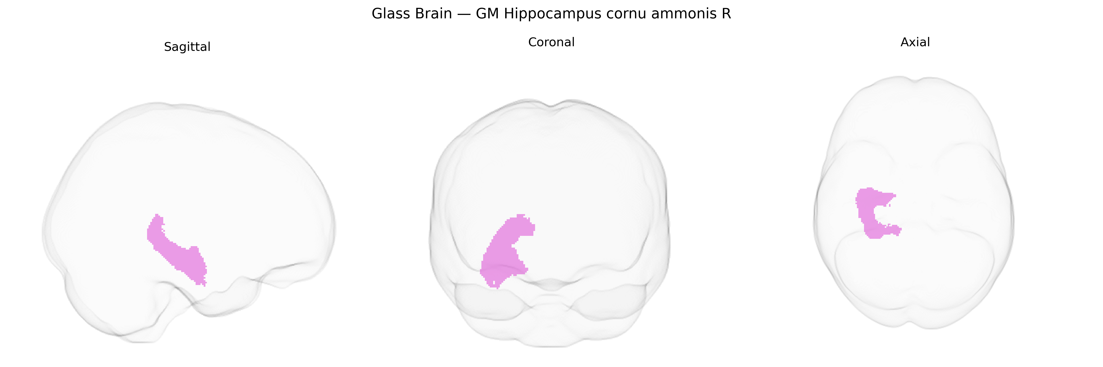 Triplanar Ghost Brain