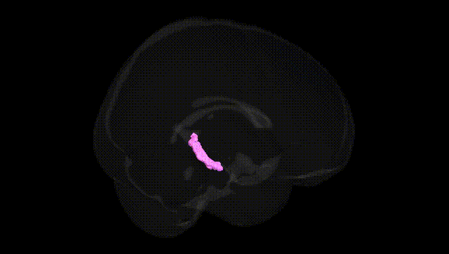 Full Brain Black