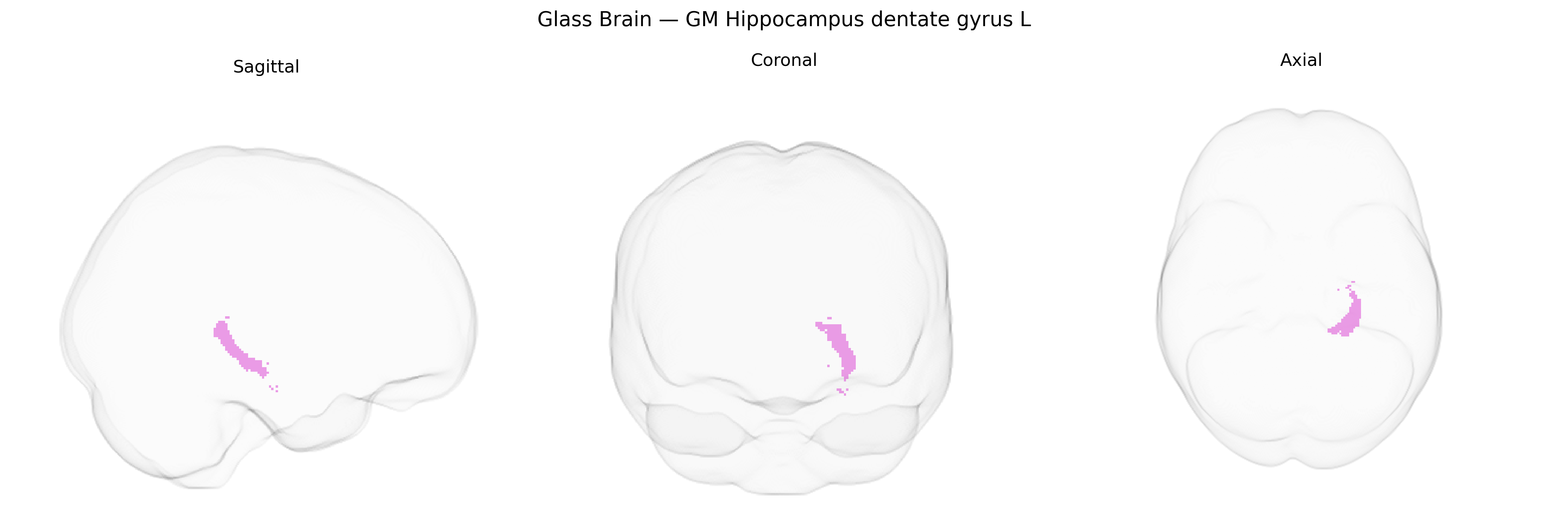 Triplanar Ghost Brain