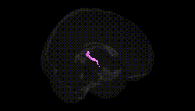 Full Brain Black