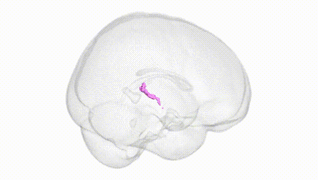 Full Brain White