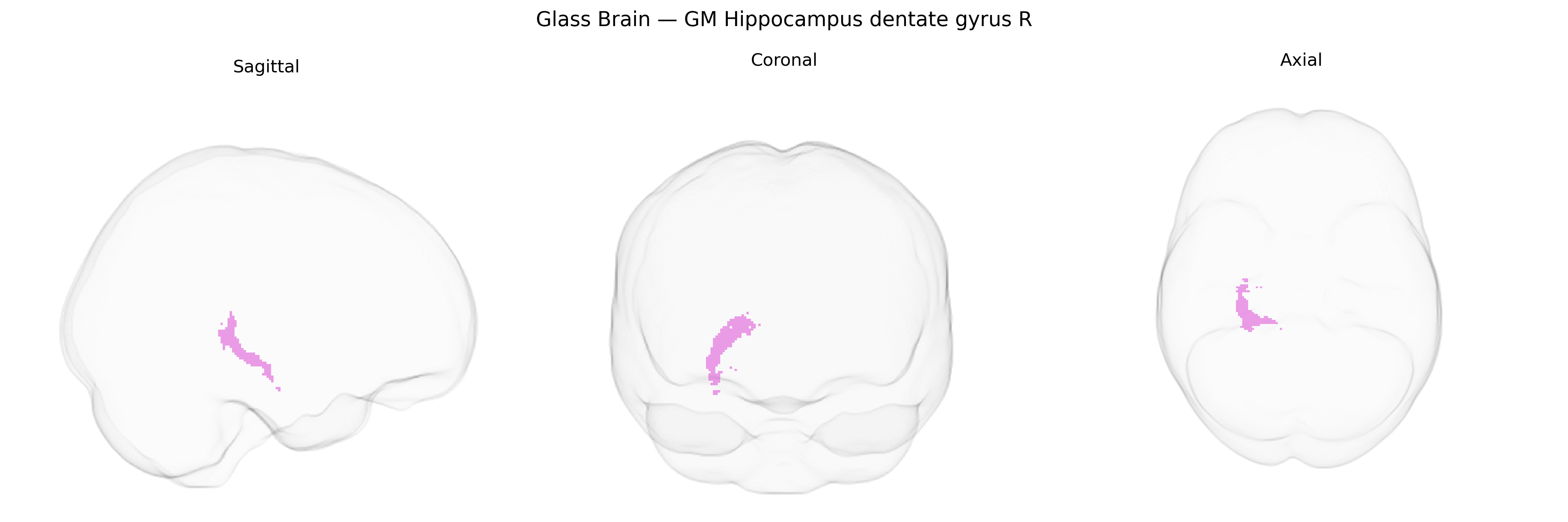 Triplanar Ghost Brain