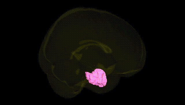 Full Brain Black