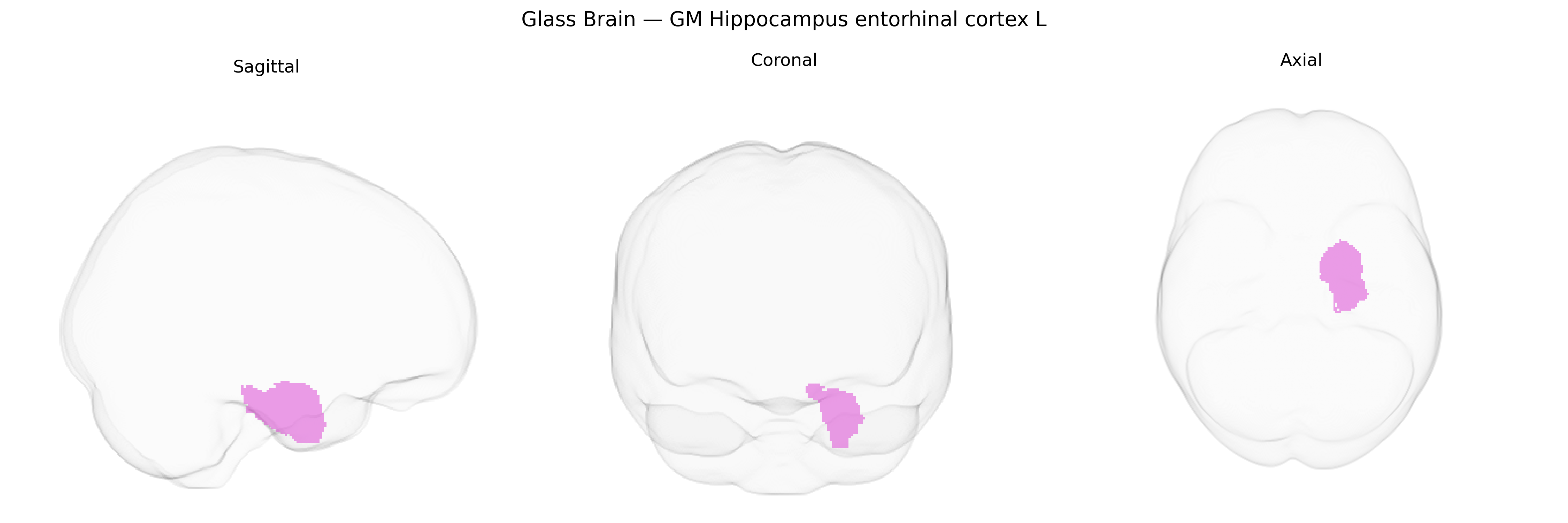Triplanar Ghost Brain