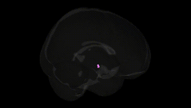Full Brain Black