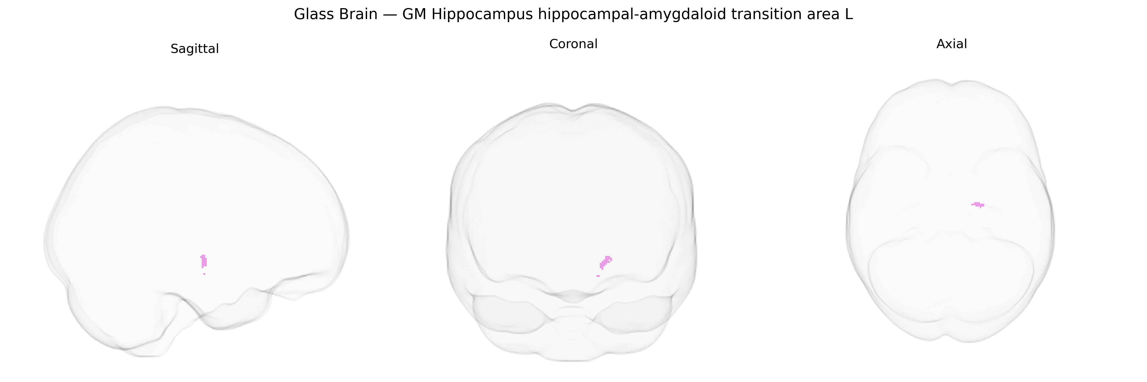 Triplanar Ghost Brain