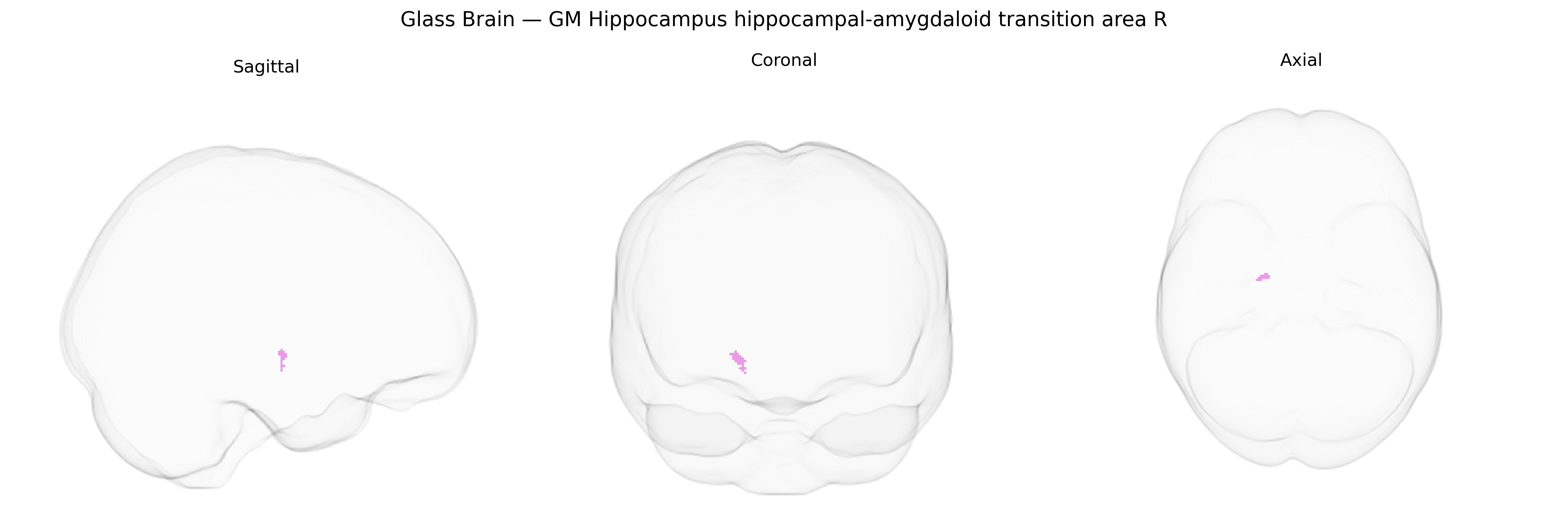 Triplanar Ghost Brain