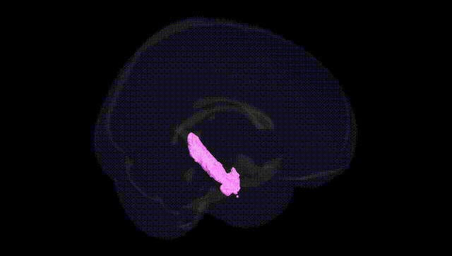 Full Brain Black