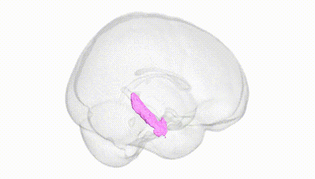 Full Brain White