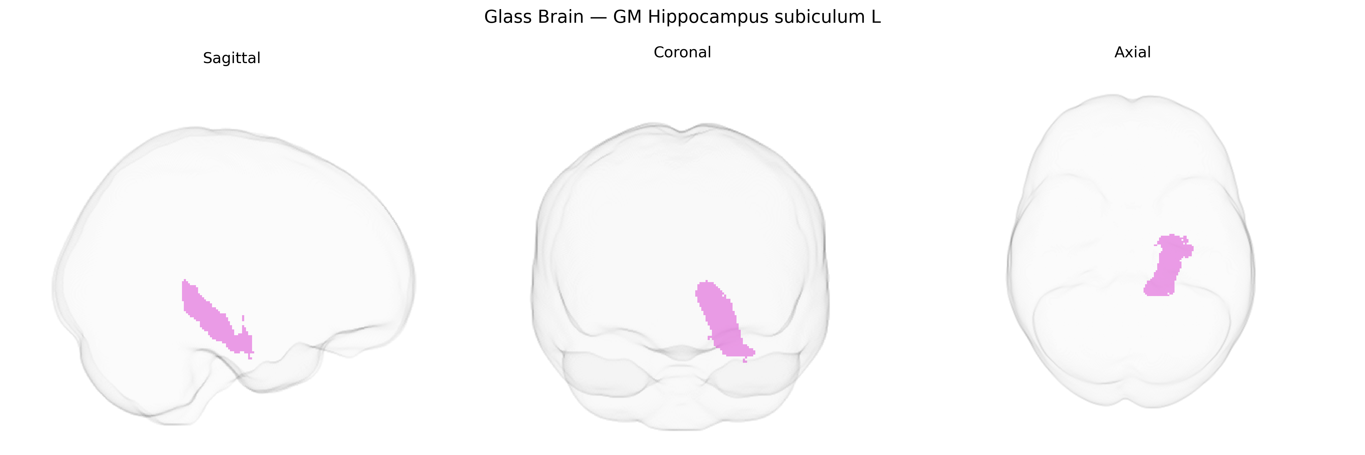 Triplanar Ghost Brain