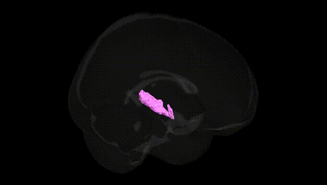 Full Brain Black