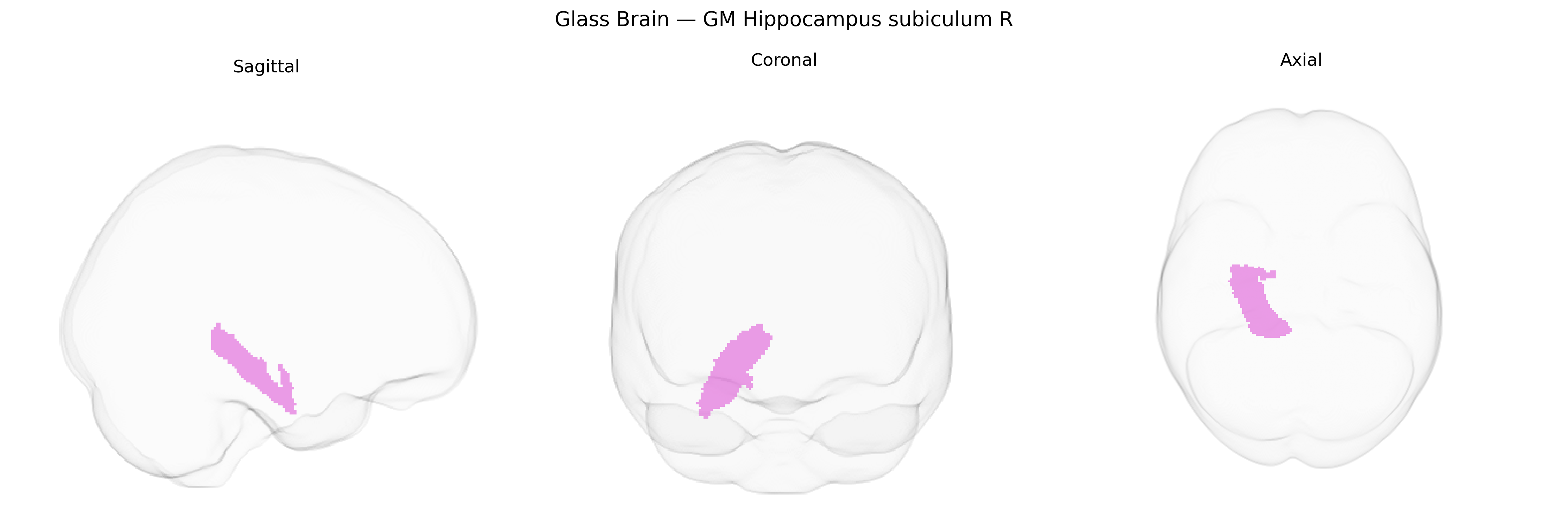 Triplanar Ghost Brain
