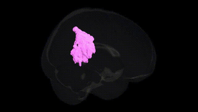 Full Brain Black