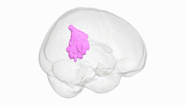 Full Brain White