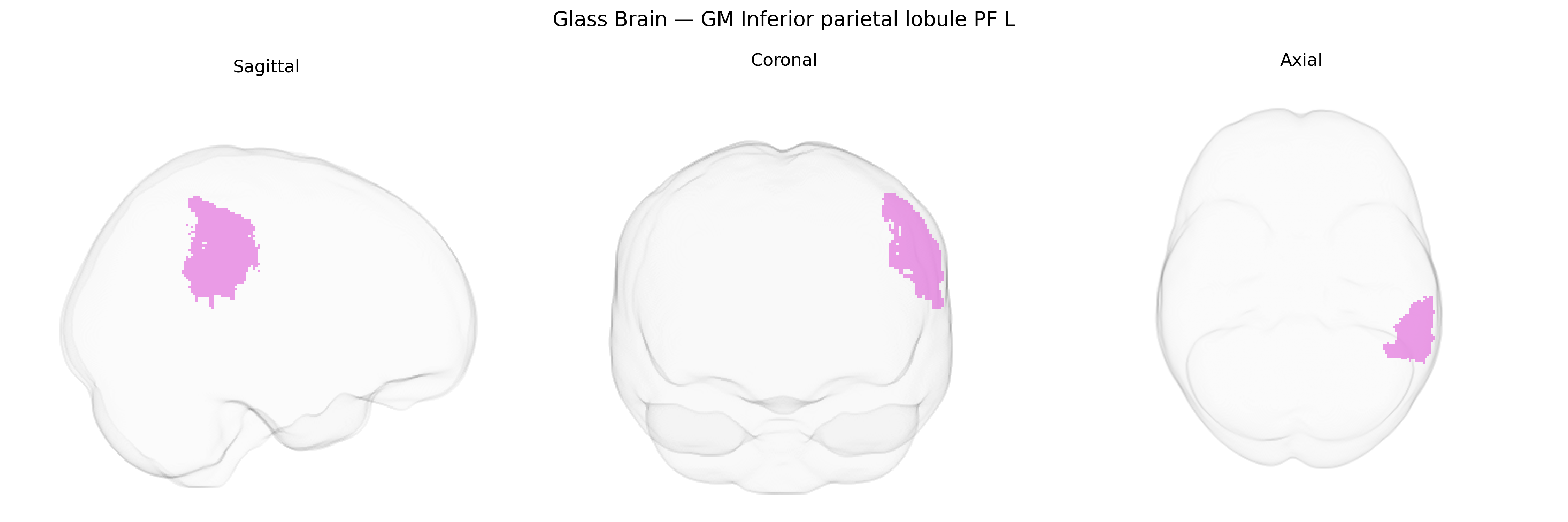 Triplanar Ghost Brain