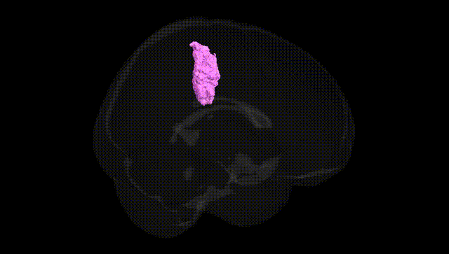 Full Brain Black