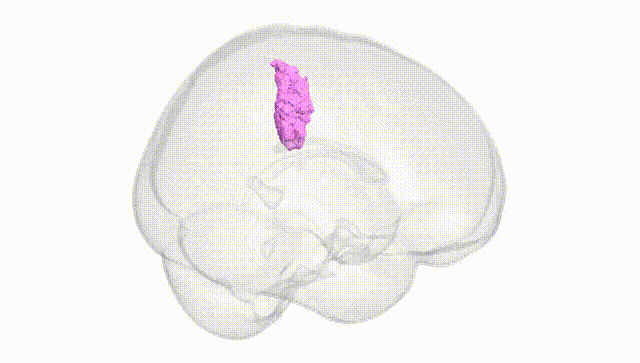 Full Brain White