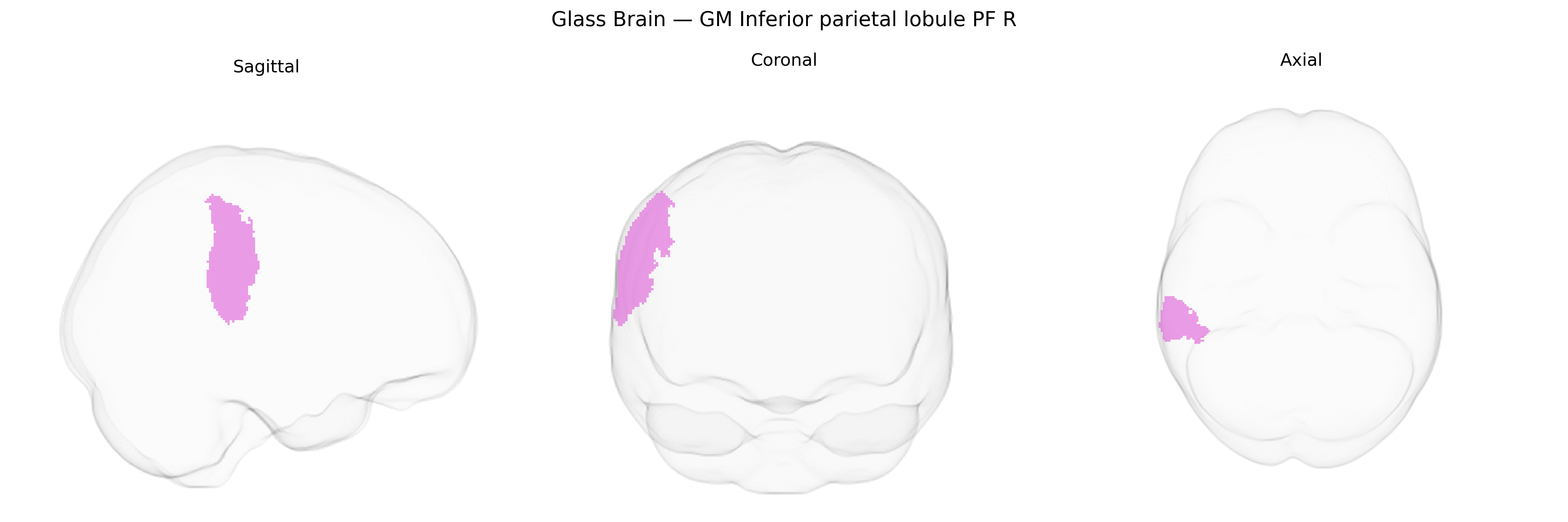 Triplanar Ghost Brain