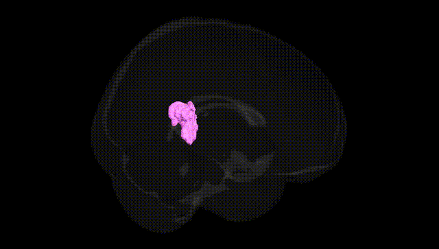 Full Brain Black