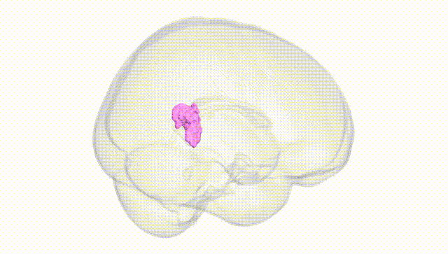 Full Brain White