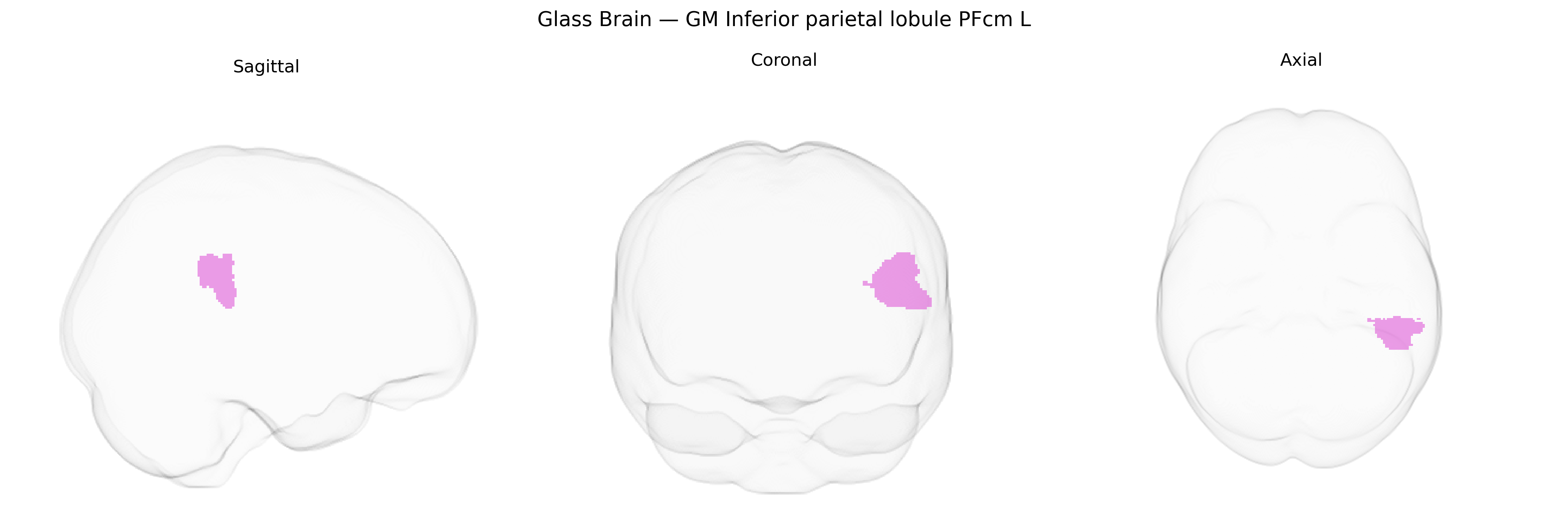 Triplanar Ghost Brain