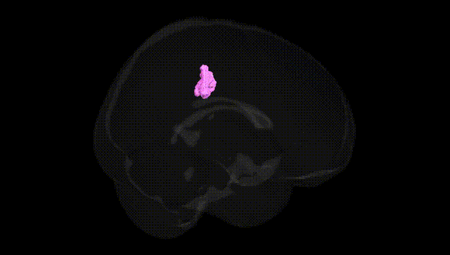 Full Brain Black