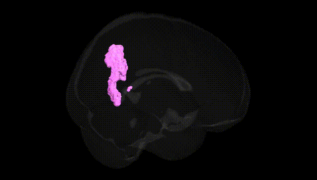 Full Brain Black