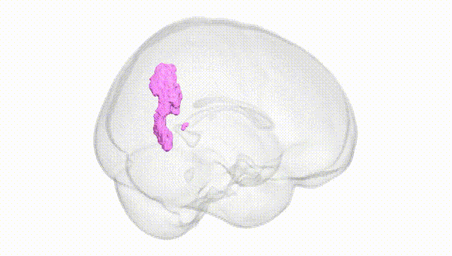 Full Brain White