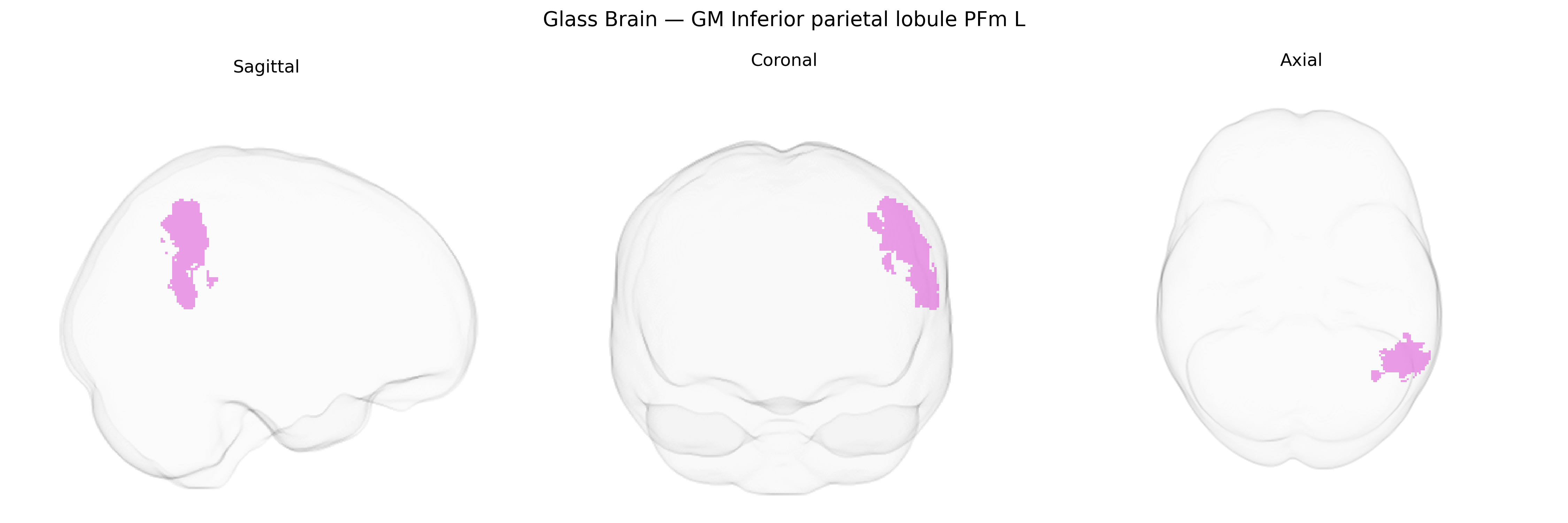 Triplanar Ghost Brain