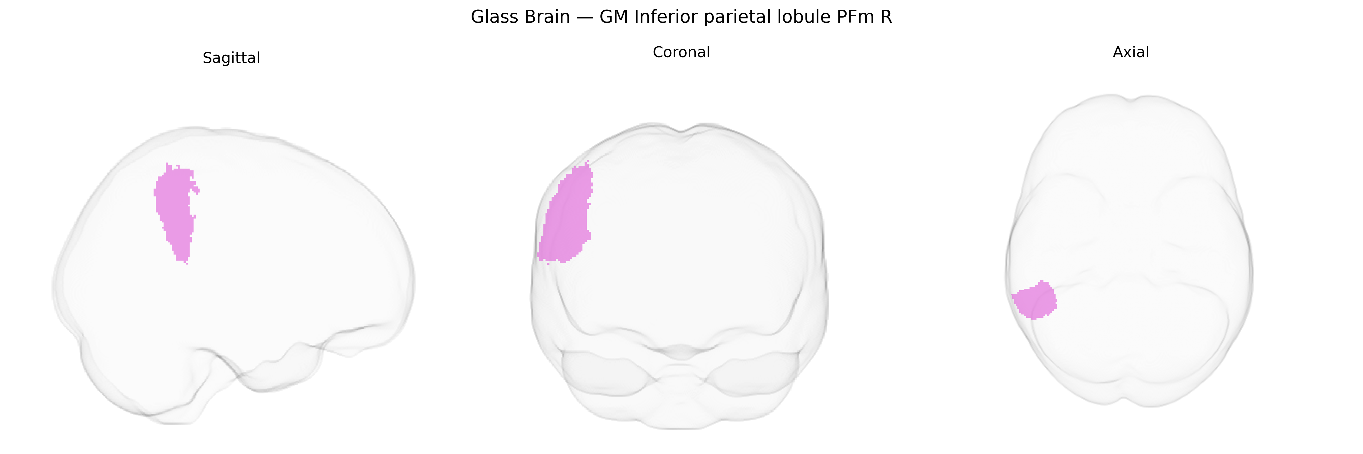 Triplanar Ghost Brain