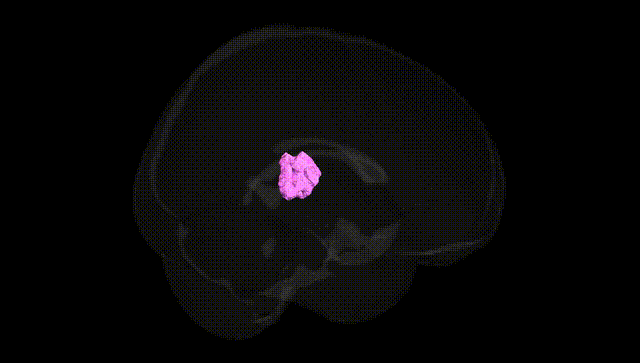 Full Brain Black