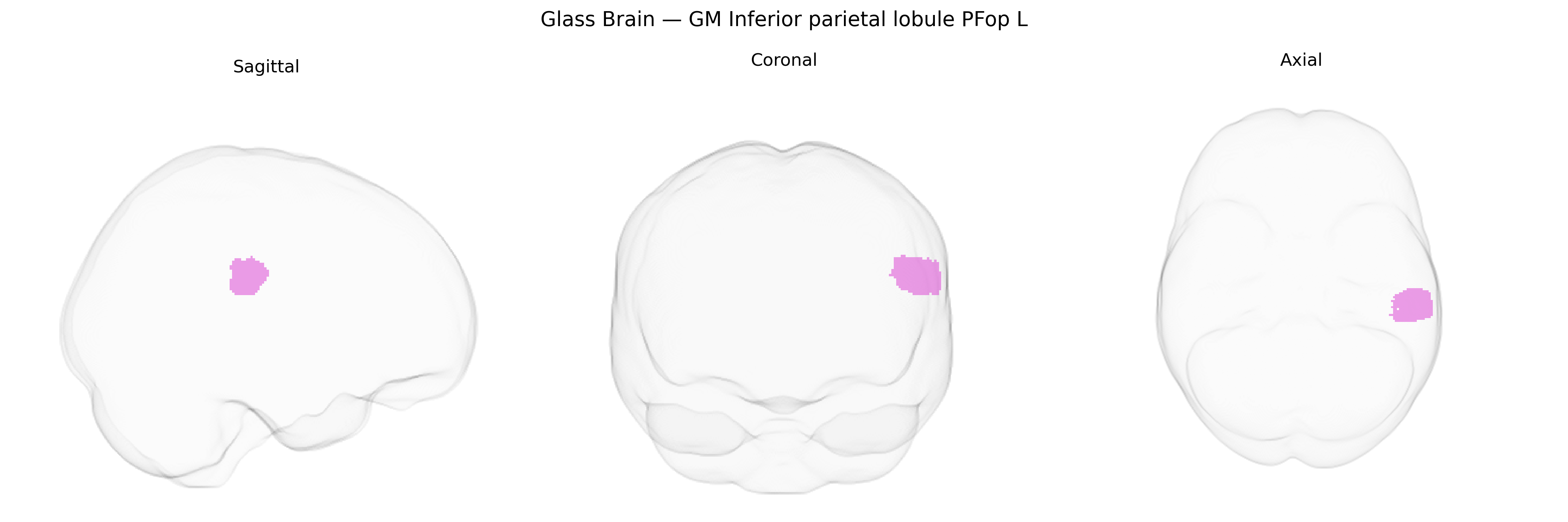 Triplanar Ghost Brain