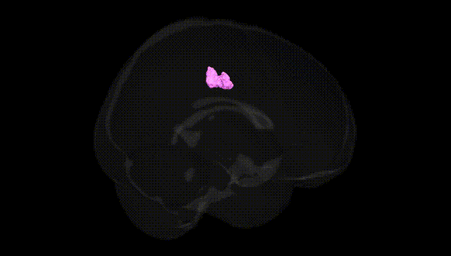Full Brain Black