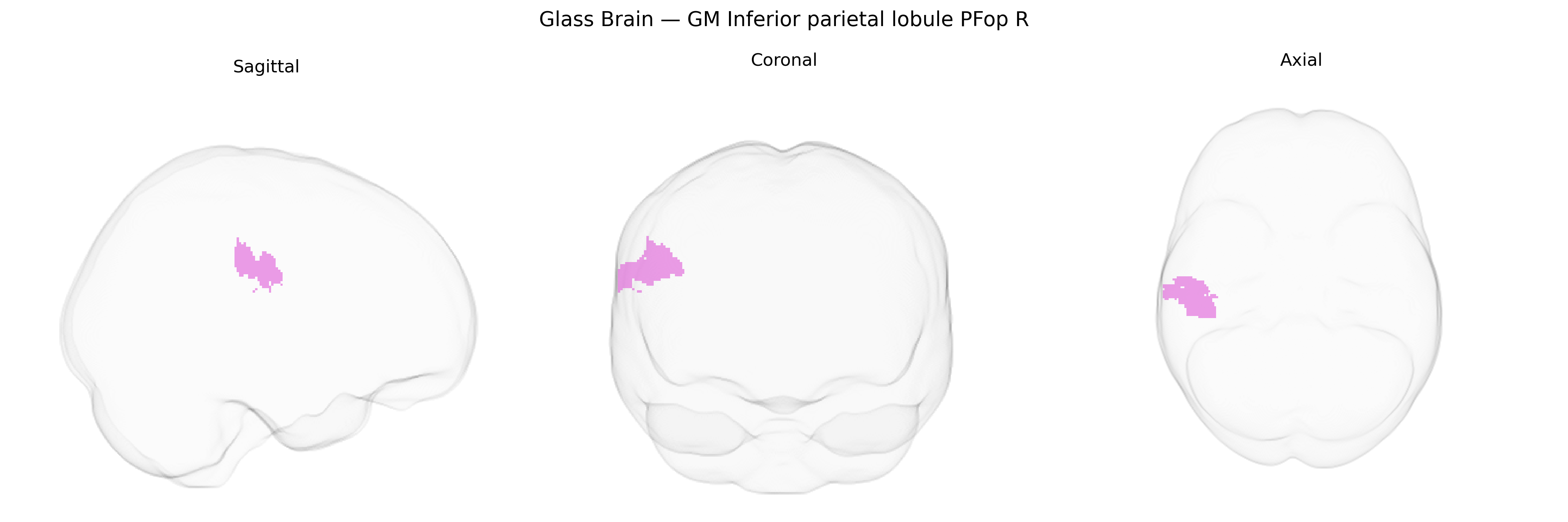 Triplanar Ghost Brain